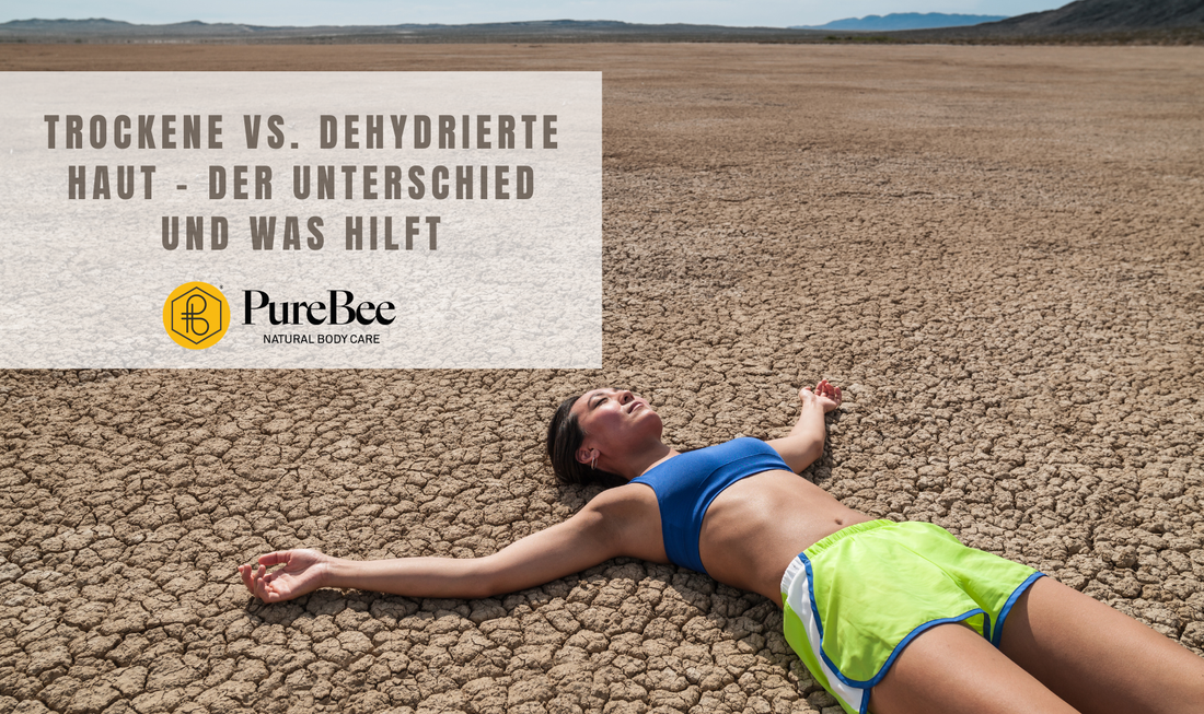 Trockene vs. dehydrierte Haut – der Unterschied und was hilft